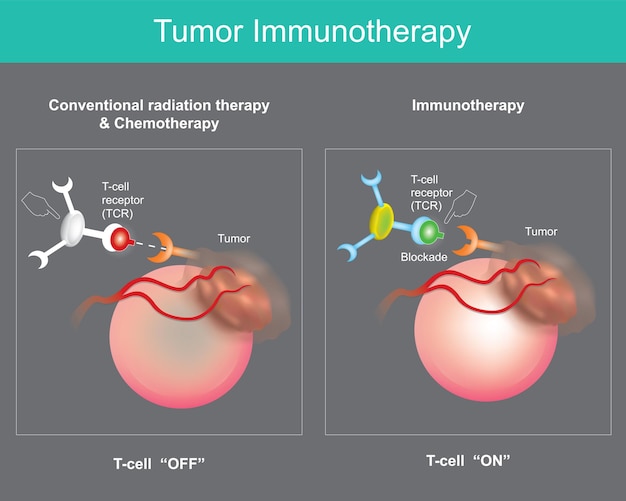 Vecteur immunothérapie des tumeurs traitement du cancer qui utilise le système immunitaire de l'organisme