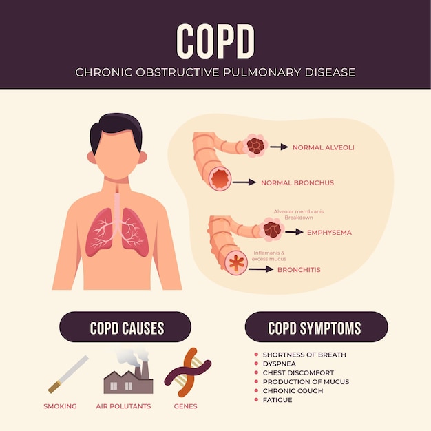 Infographie De Copd Dessiné à La Main