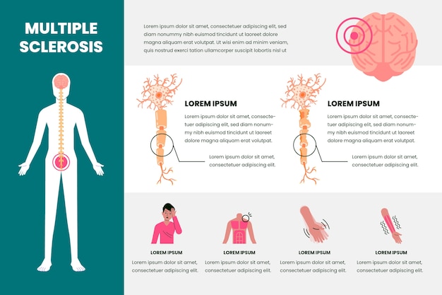 Vecteur infographie de la sclérose en plaques design plat dessiné à la main