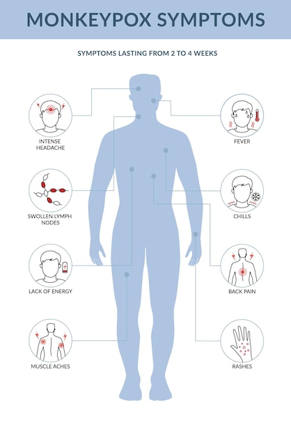 Infographie Des Symptômes De La Variole Du Singe Il Provoque Des Infections Cutanées Illustration Vectorielle à Ligne Plate