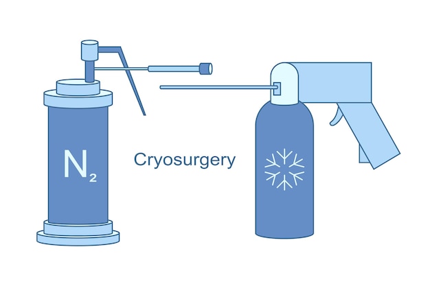 Vecteur instruments cryo pour la cryochirurgie illustration de la ligne vectorielle azote liquide