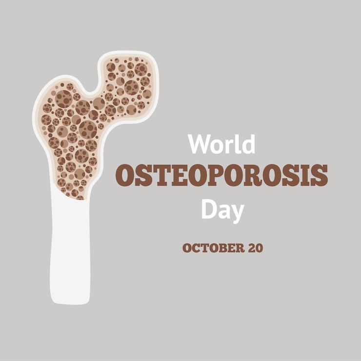 Journée mondiale de l'ostéoporose Affiche d'information sur l'arthrose des os anatomiques humains
