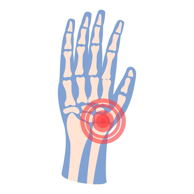 Main arthrite icône dessin animé vecteur douleur articulaire patient médical