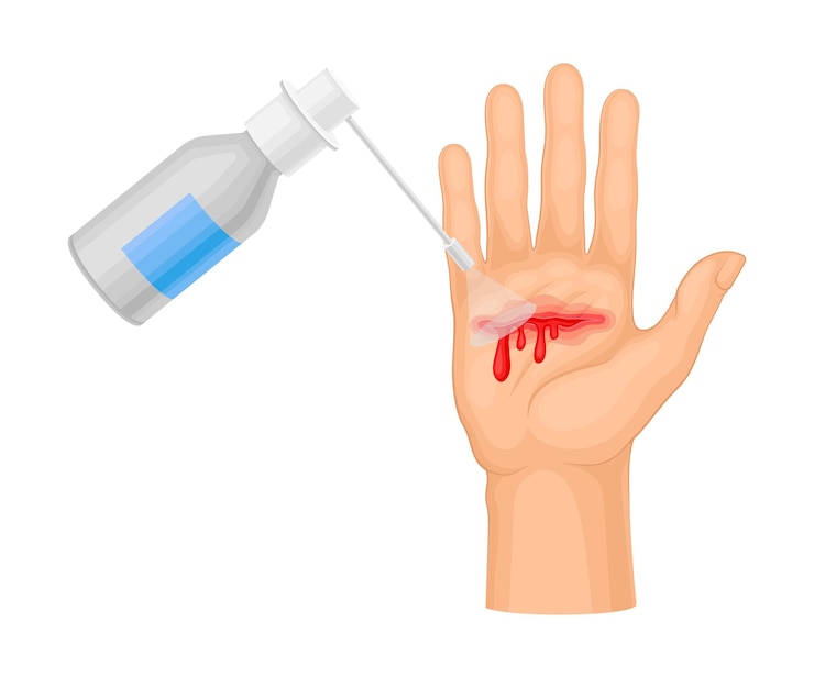 Vecteur la main avec la plaie coulant du sang le nettoyage avec des substances pharmaceutiques illustration vectorielle de la procédure