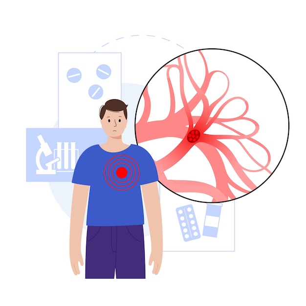 Vecteur maladie d'embolie pulmonaire