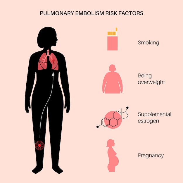 Vecteur maladie d'embolie pulmonaire