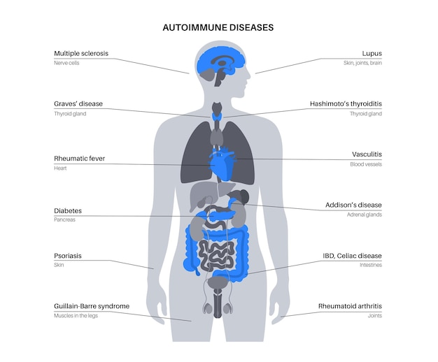 Maladies Auto-immunes