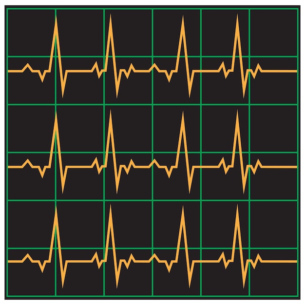 Modèle De Vecteur D'illustration De Ligne D'impulsion