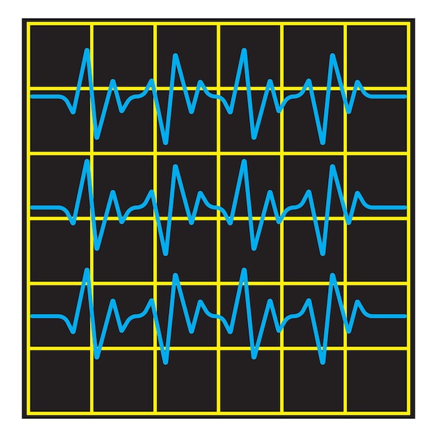 Vecteur modèle de vecteur d'illustration de ligne d'impulsion