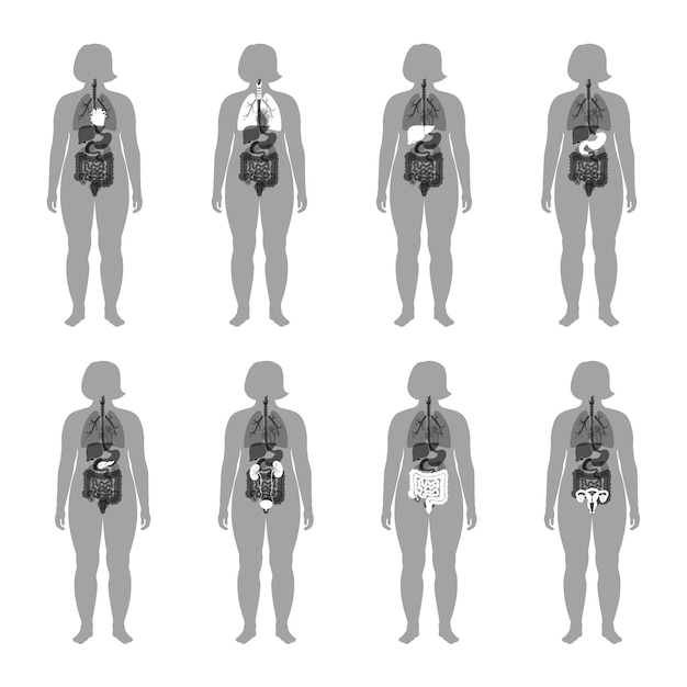 Organes Internes Dans Le Corps Féminin Obèse