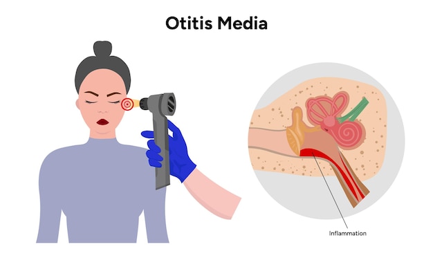 Otite médiane inflammation anatomie de l'oreille humaine douleur maladie infographique médicale et consulter un médecin