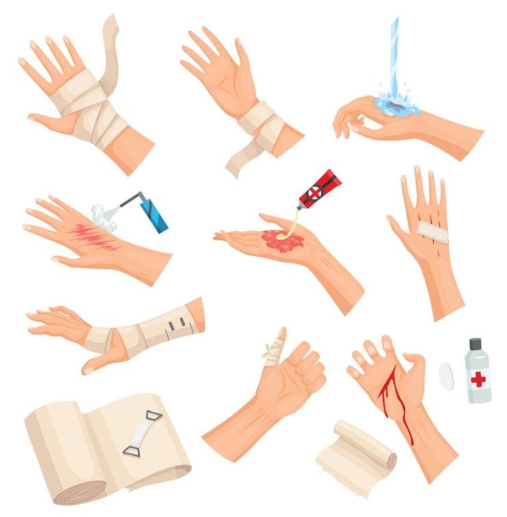 Vecteur peau blessée aux mains et procédures de pansement et de nettoyage des plaies premiers soins pour la plaie guérison ou traitement médical première aide d'urgence pour un traumatisme de la main humaine