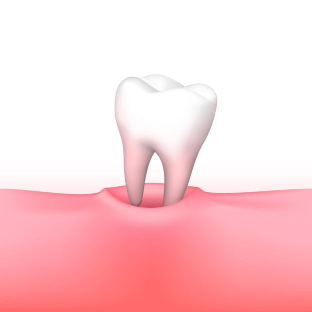 Perte De Dents Sur Fond Blanc. Illustration Vectorielle