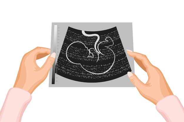 Photographie d'une échographie de l'embryon d'un bébé à naître dans les mains de la mère Vecteur d'illustration