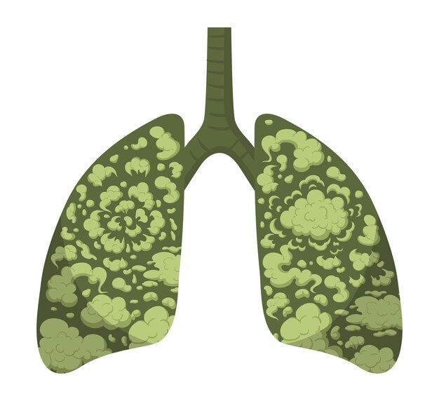 Poumons pollués Caricature d'un système respiratoire malsain illustration à vecteur plat