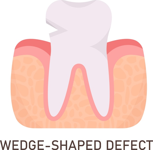Vecteur problème de dent défectueuse en forme de coin
