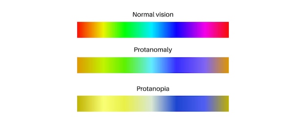 Vecteur protanomalie et protanopie