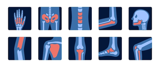 Radiographies Du Squelette Humain Et De L'anatomie Articulaire Avec Des Parties Douloureuses Examen Radiographique Des Os Et Du Crâne