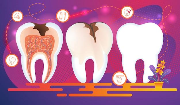 Vecteur rangée de dents avec des problèmes dentaires