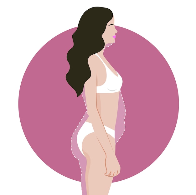 Vecteur réduction de la graisse corporelle de la femme et liposuccion