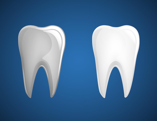Set de blanchiment des dents Évolution du blanc dentaire