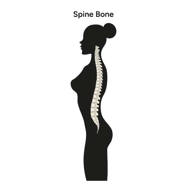 Silhouettes De Femme Et Anatomie De La Colonne Vertébrale En Vecteur