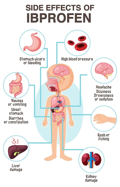 Vecteur style de dessin animé de diagramme d'anatomie humaine des effets secondaires de l'ibuprofène