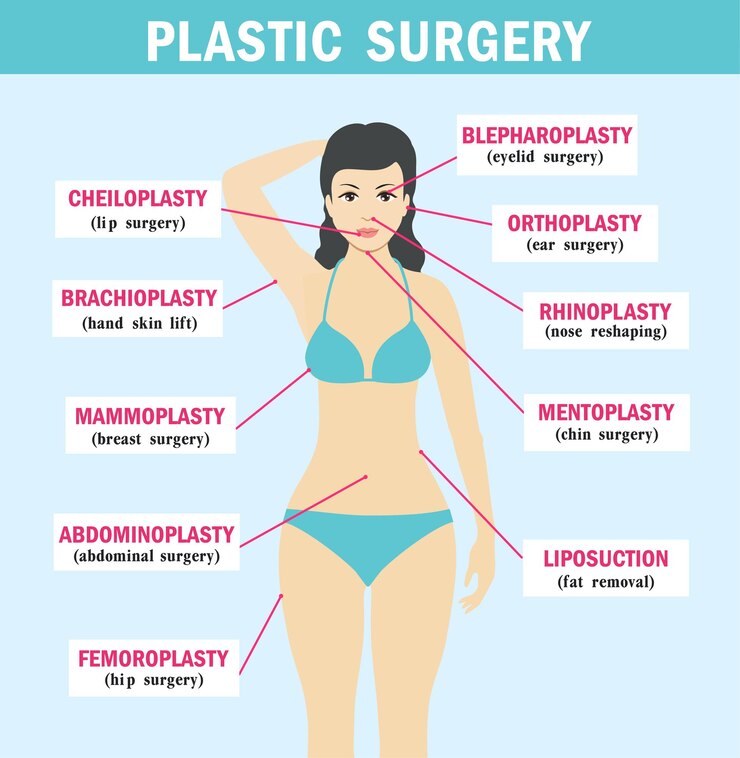 Vecteur surspécialités de la chirurgie plastique infographie de la chirurgie plastique types de chirurgie plastique médecine corps
