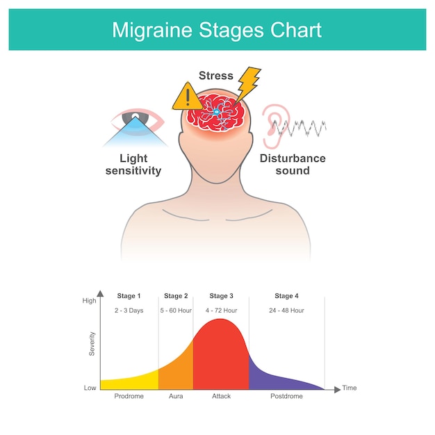 Vecteur tableau des stades de la migraine tableau des stades de la migraine et facteurs responsables du symptôme de la migrainexa