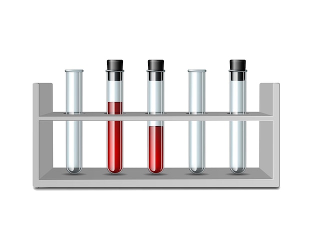 Testez les tubes de verre dans le rack. Équipement pour la science de la biologie, l'éducation ou les tests médicaux. Ensemble de verrerie scientifique ou médicale - Tube à essai transparent vide et tube à essai rempli de sang. Vecteur