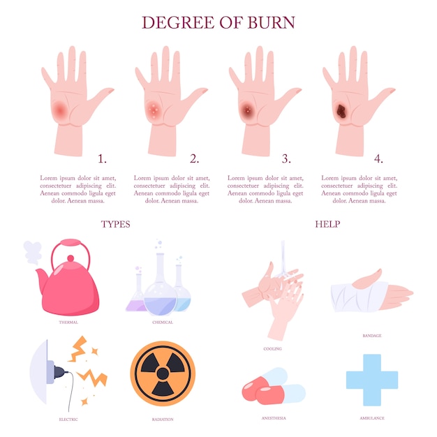 Traitement Des Brûlures Cutanées Et étapes Infographiques.