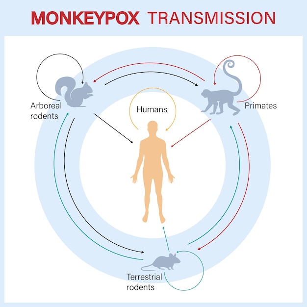 Transmission Du Virus De La Variole Du Singe. La Propagation De L'épidémie. Une éclosion D'une épidémie Virale.