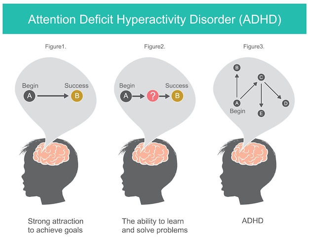 Vecteur trouble déficitaire de l'attention avec hyperactivité expliquer les modes de pensée et de résolution de problèmes qui sont arrivés au cerveau de l'enfant