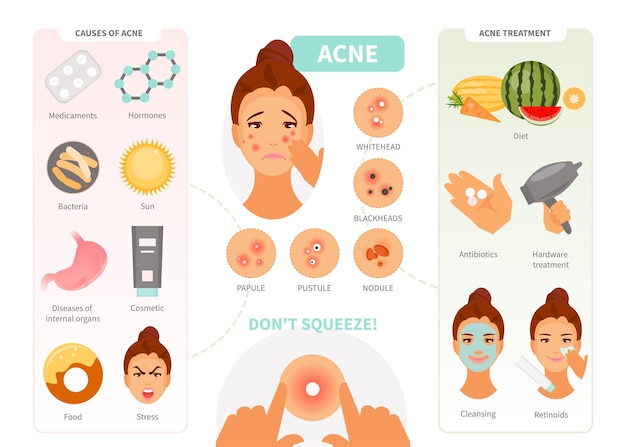 Types De Causes Et Traitement De L'acné