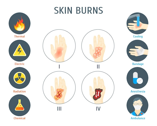 Vecteur d'affiche de carte infographique de brûlures de peau humaine