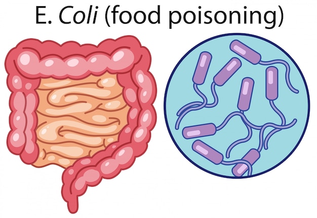 Un Vecteur De Bactéries E Coli