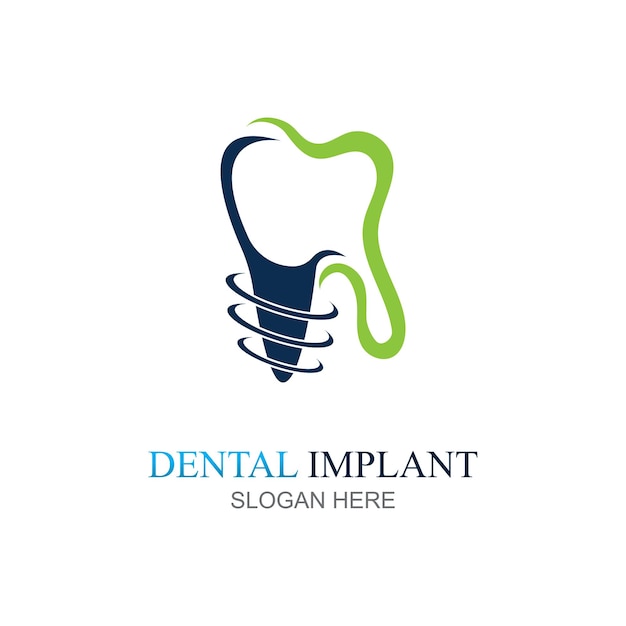 Vector de conception du logo de l'implant dentaire modèle de logo de soins dentaires