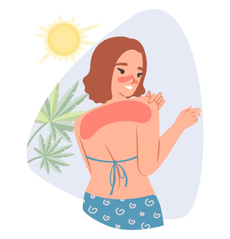 Vecteur vector de coup de soleil jeune femme soignant rougeur de l'épaule