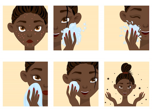 Vecteur visage de femme à la peau foncée avec étapes de guérison de l'acné. style de bande dessinée.