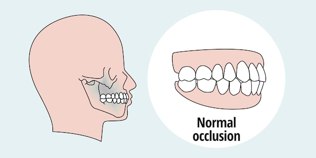 Vecteur vue latérale des dents après traitement orthodontique, dents alignées