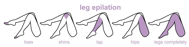 Vecteur zones d'épilation des jambes problèmes d'épilation jambes féminines patchs de soins de la peau follicules pileux