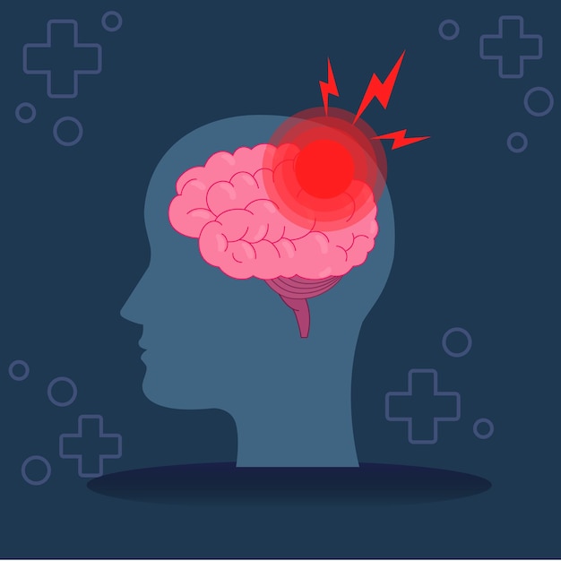 Illustration of Brain with Pain Symbol Highlighting Headache or Migraine