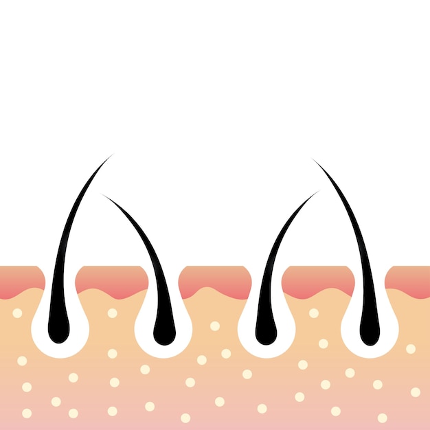 Skin anatomy Hair follicle Skin layers Dermatology concept Hair roots inside the skin