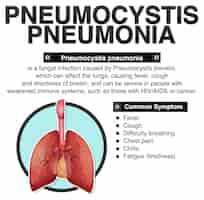 Vector gratuito afiche informativo de neumonía por pneumocystis