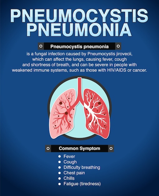 Vector gratuito afiche informativo de neumonía por pneumocystis