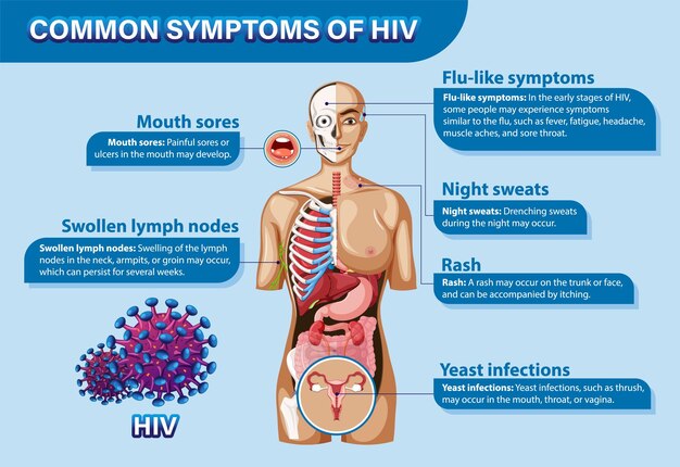 Afiche informativo de síntomas comunes del VIH
