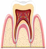 Vector gratuito anatomía del diente en las encías sobre fondo blanco.