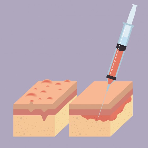 Capas de piel con inyección de botox