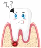 Vector gratuito caries e inflamación en las encías sobre un fondo blanco.