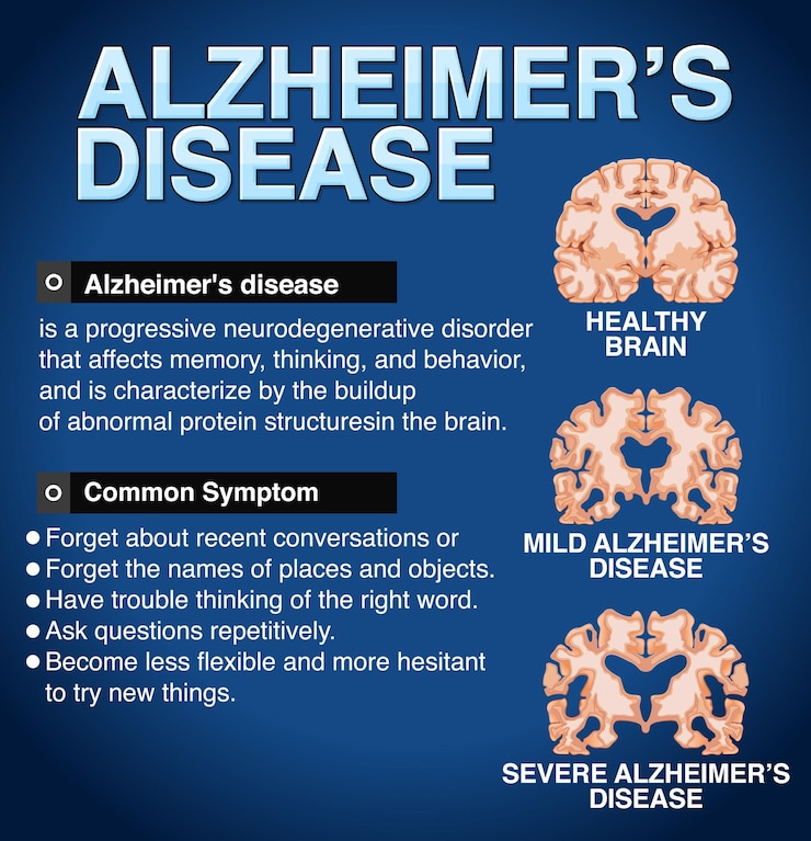 Vector gratuito cartel informativo de la enfermedad de alzheimer